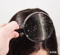 有哪些好用的去屑洗发水 去屑止痒洗发水推荐