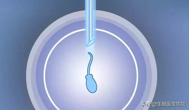 做人工授精需要做哪些检查 人工受孕需要什么条件