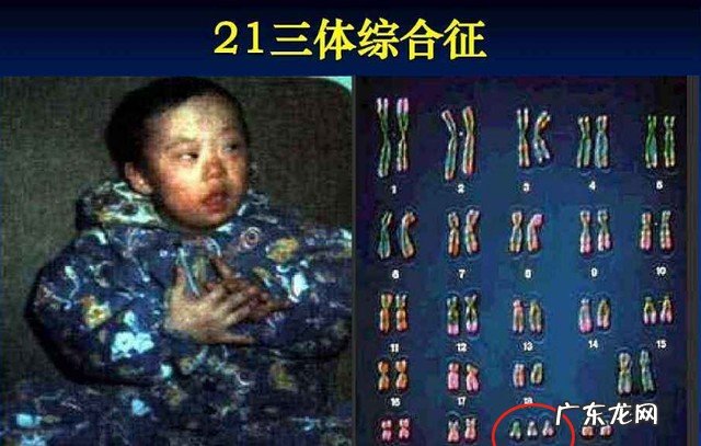 做唐筛有什么注意事项 孕期产检时间表分享