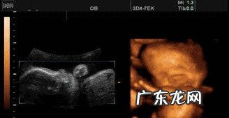四维检查要注意什么 怀孕几个月的时候可以做四维