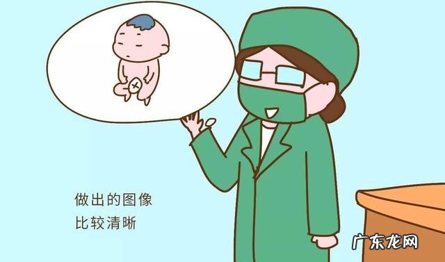 四维检查要注意什么 怀孕几个月的时候可以做四维