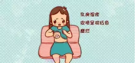 有哪些解决湿疹的小妙招 孕妇湿疹特别痒怎么办