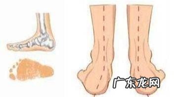 坐月子脚后跟疼是什么原因 产后脚后跟疼要如何改善