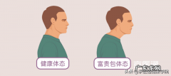 富贵包骨头突出有什么办法矫正 关于富贵包的简单介绍