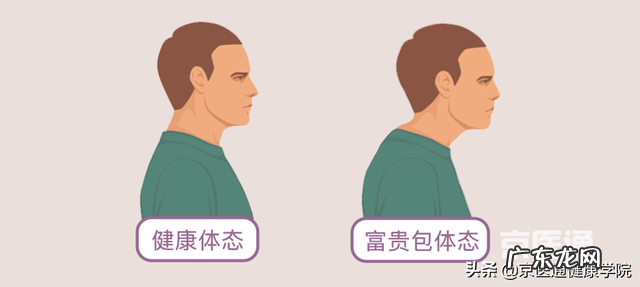 富贵包骨头突出有什么办法矫正 关于富贵包的简单介绍