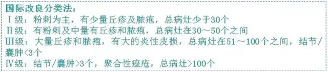 轻度痤疮一天一粒异维a酸 痤疮按照严重程度分4级