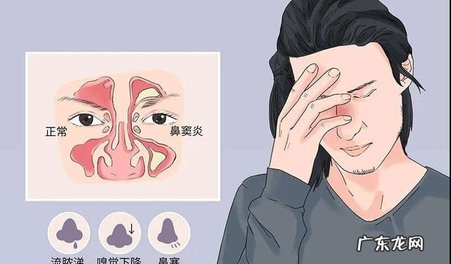 鼻炎吃什么药效果最好 治鼻炎的中成药推荐